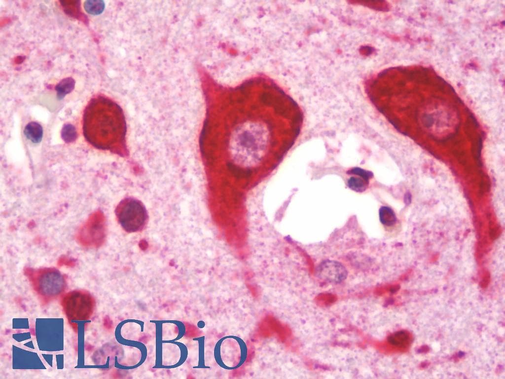 IHC-plus™ MC1R Antibody (aa205-232)