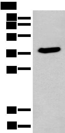 ACBD4 Antibody