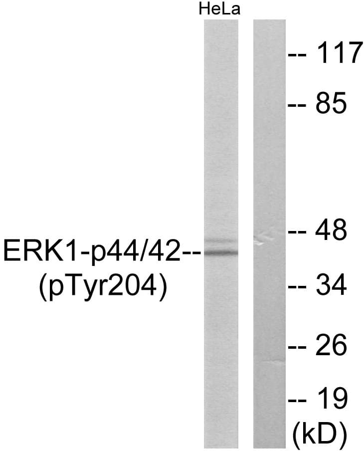 ERK1 + ERK2 Antibody (phospho-Tyr204)