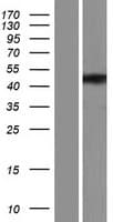 ZFYVE27 / Protrudin Protein (Over-Expression Lysate Myc-DDK (Flag))