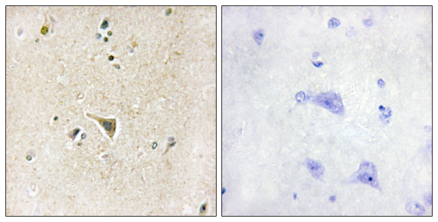 LRRK1 Antibody (aa361-410)