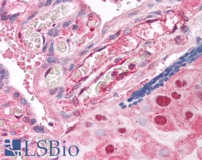 IHC-plus™ SLC16A3 Antibody