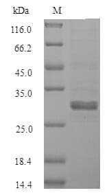Human SALL2 Protein (Recombinant DDK,C-terminus)