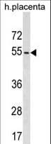 Polyclonal Rabbit anti-Human KIRREL2 / FILTRIN Antibody (aa190-216, WB)