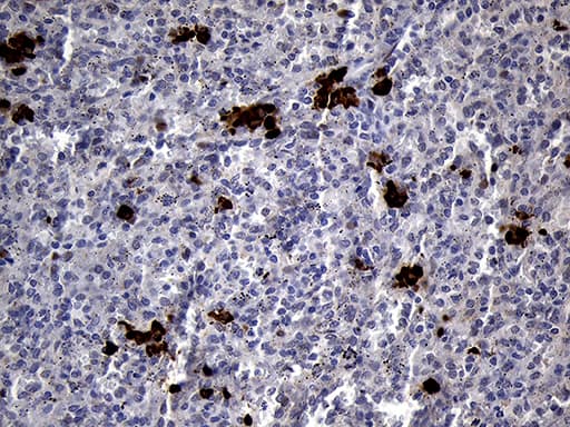 Monoclonal Mouse anti-Human RACGAP1 / MGCRACGAP Antibody (clone OTI4H8, aa123-238, IHC, WB)