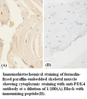 PDK4 Antibody
