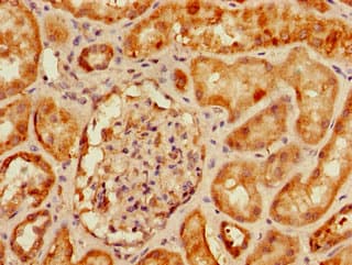 SLC9A3R2 / SIP1 Antibody