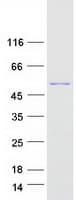 Human GKAP1 Protein (Recombinant Myc-DDK (Flag))