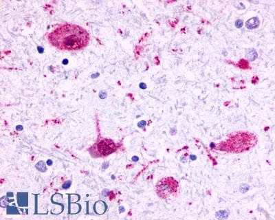 PathPlus™ GPR17 Antibody (Cytoplasmic Domain)