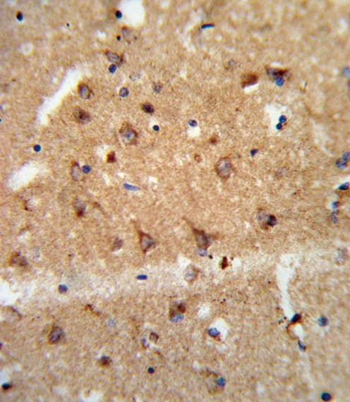GDNF Antibody (aa8-36)