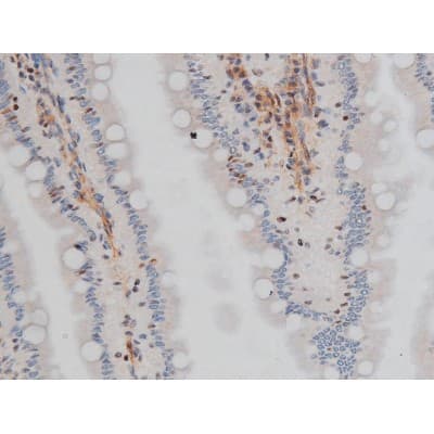 CREB1 / CREB Antibody (phospho-Ser133)