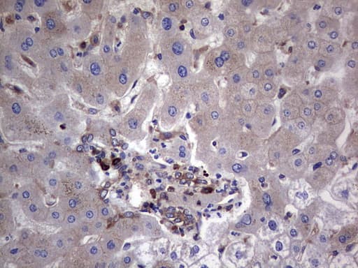 GARS / Glycyl tRNA Synthetase Antibody (clone OTI4G4)