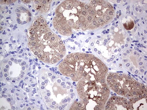 CMT2 / MAD2L1BP Antibody (clone OTI3C11)