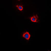 ADCY5+6 Antibody (C-Terminus)