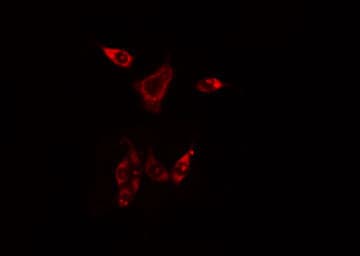 PHKG1 Antibody