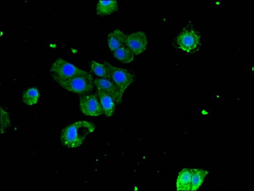 SERPING1 / C1 Inhibitor Antibody