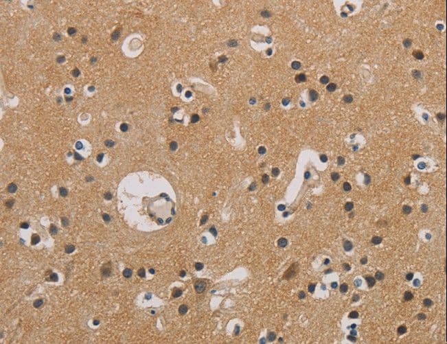 Polyclonal Rabbit anti-Human ITGB3BP Antibody (IHC)