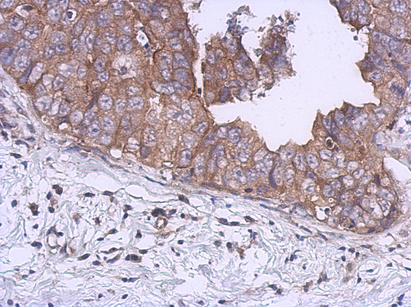 Polyclonal Rabbit anti-Human Kinesin Heavy Chain / KIF5B Antibody (aa901-963, IHC, WB)