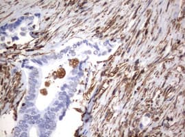 Vimentin Antibody (clone OTI1A9)