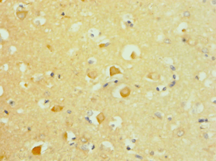 Polyclonal Rabbit anti-Human APLP2 Antibody (aa340-450, IHC)