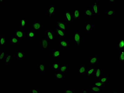 HIST1H1E Antibody