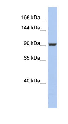 Polyclonal Rabbit anti-Human PMS2 Antibody (aa611-660, WB)