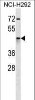 AKR1C4 / Chlordecone Reductase Antibody (aa11-39)