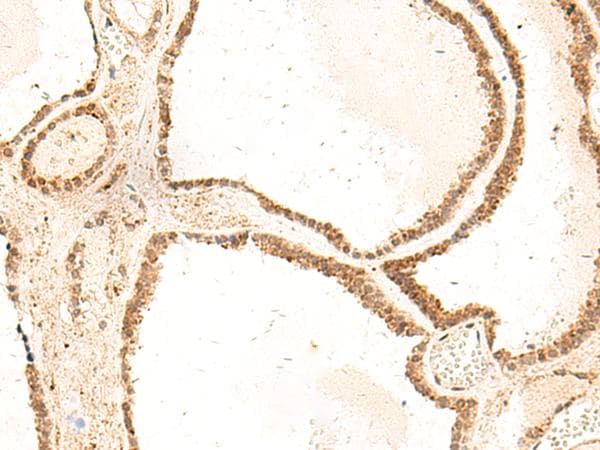 Polyclonal Rabbit anti-Human ZFYVE27 / Protrudin Antibody (IHC)