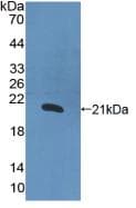 Human IL1A / IL-1 Alpha Protein (Recombinant His, N-Terminal)