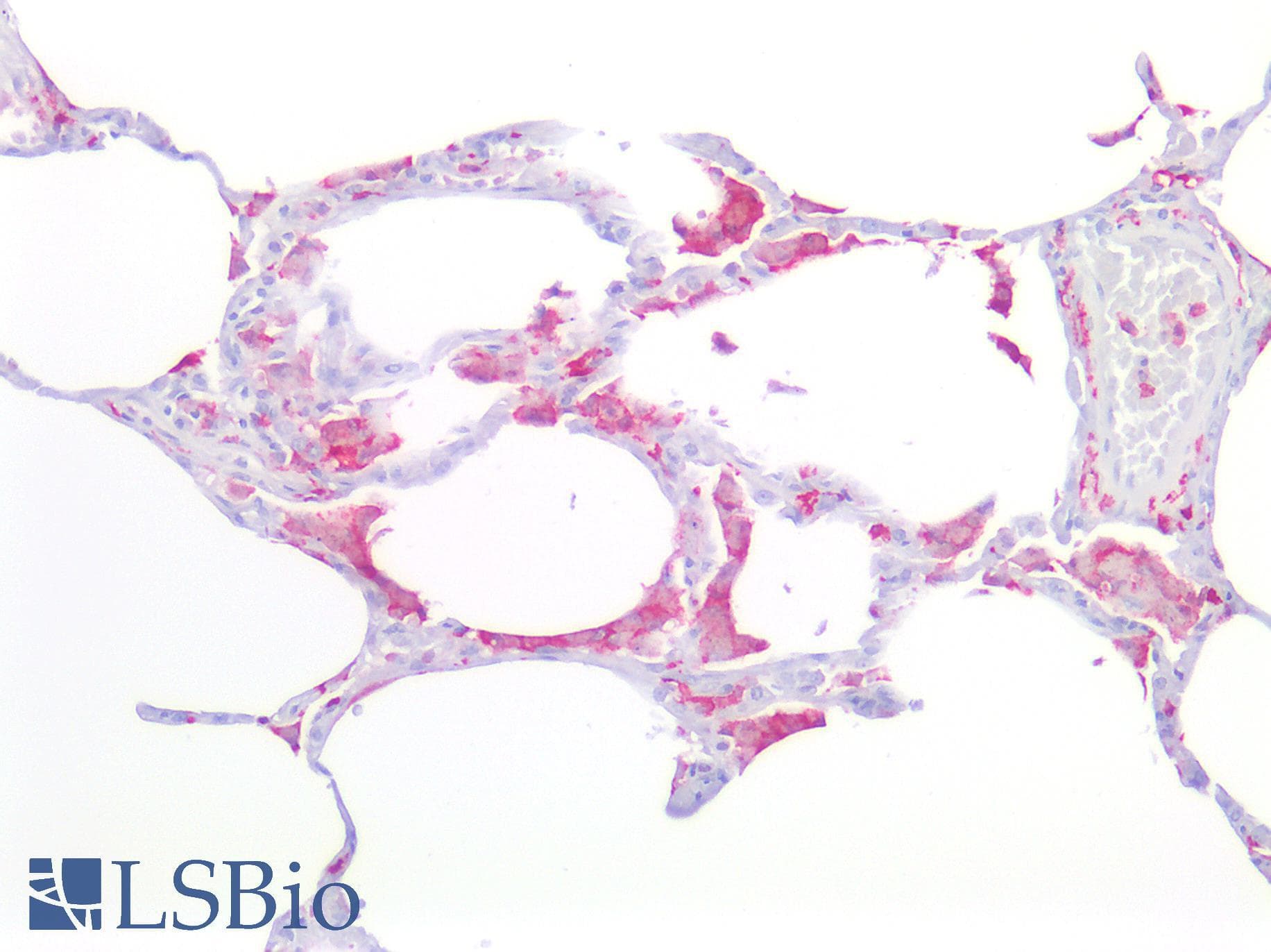 IHC-plus™ Polyclonal Rabbit anti-Human AIF1 / IBA1 Antibody (IHC, IF, WB)