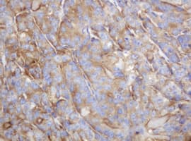 Monoclonal Mouse anti-Human TAPBPL / TAPBPR Antibody (clone OTI3D8, IHC, WB)