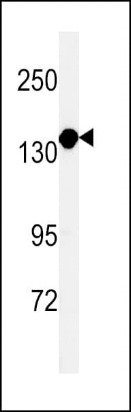 FSCN1 / Fascin Antibody (aa146-174)