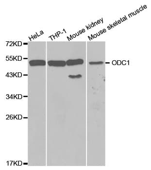 Polyclonal Rabbit anti-Human ODC1 / Ornithine Decarboxylase Antibody (IHC, WB)