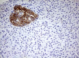 HADH Antibody (aa57-314, clone OTI3D12)