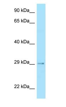 STC2 / Stanniocalcin 2 Antibody (C-Terminus)