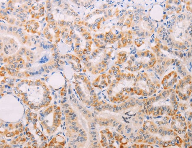 Polyclonal Rabbit anti-Human MAP3K12 Antibody (IHC)
