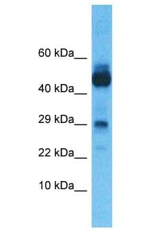 NANOS1 / NOS1 Antibody (aa48-97)