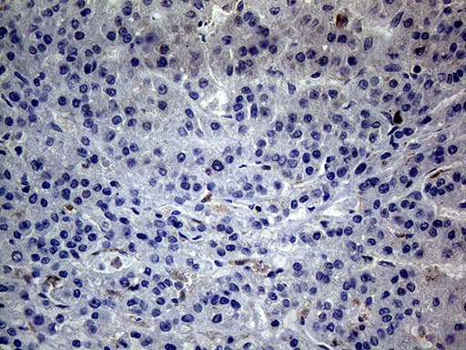 ANGPTL8 / Betatrophin Antibody (aa22-198, clone OTI5E2, Carrier-free)