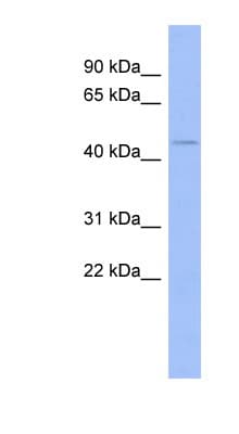 ZNF70 Antibody (N-Terminus)