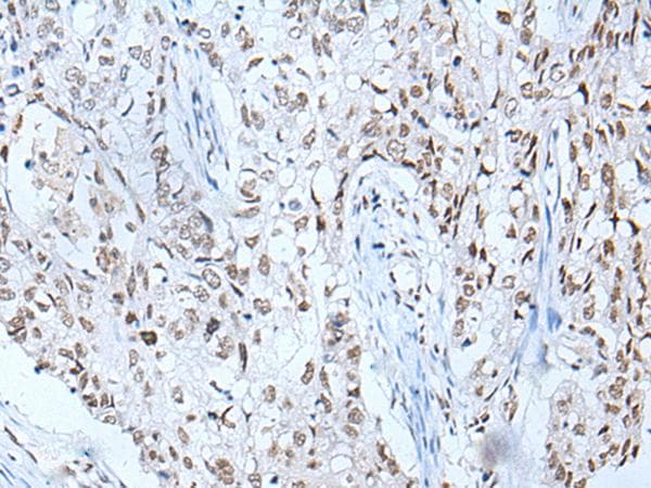 BRD3 Antibody