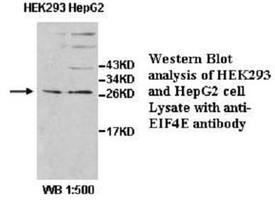 EIF4E Antibody (aa2-217)