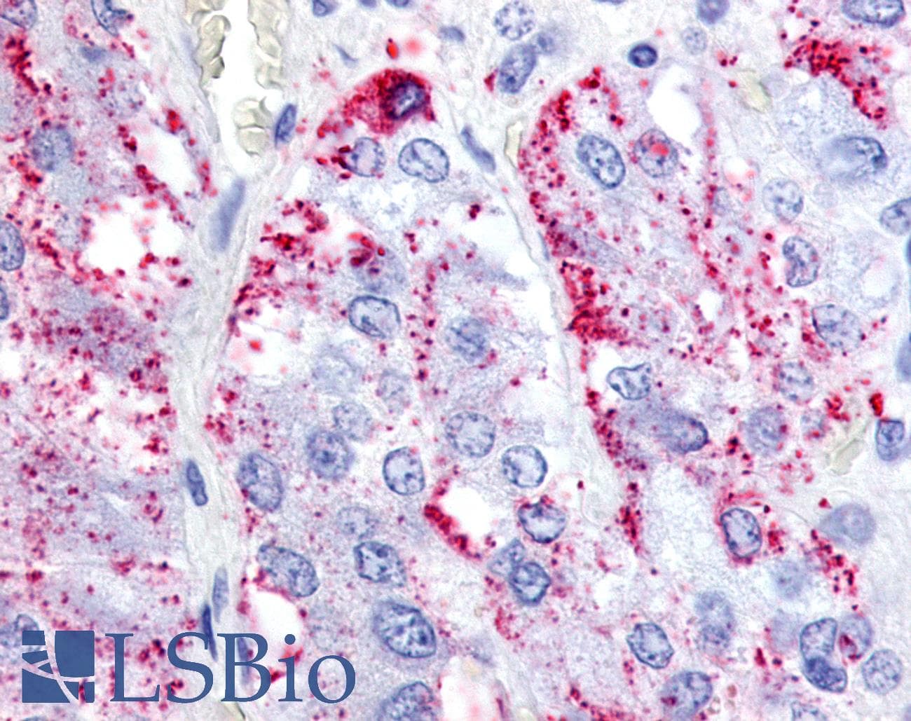 IHC-plus™ Polyclonal Rabbit anti-Human RXFP1/ LGR7 Antibody (N-Terminus, IHC)