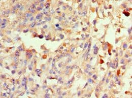 Polyclonal Rabbit anti-Human S100B / S100 Beta Antibody (aa1-92, IHC)