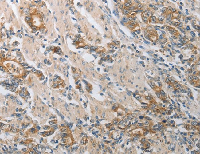 Polyclonal Rabbit anti-Human CST3 / Cystatin C Antibody (IHC, WB)