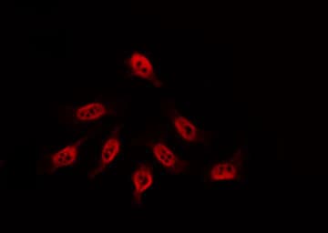LW-1 / HSFX1 Antibody