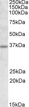 IHC-plus™ Polyclonal Goat anti-Human UCP2 Antibody (aa101-113, IHC, IF, WB)