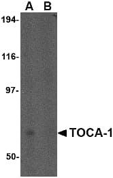 Polyclonal Rabbit anti-Human TOCA1 / FNBP1L Antibody (IHC, IF, WB)