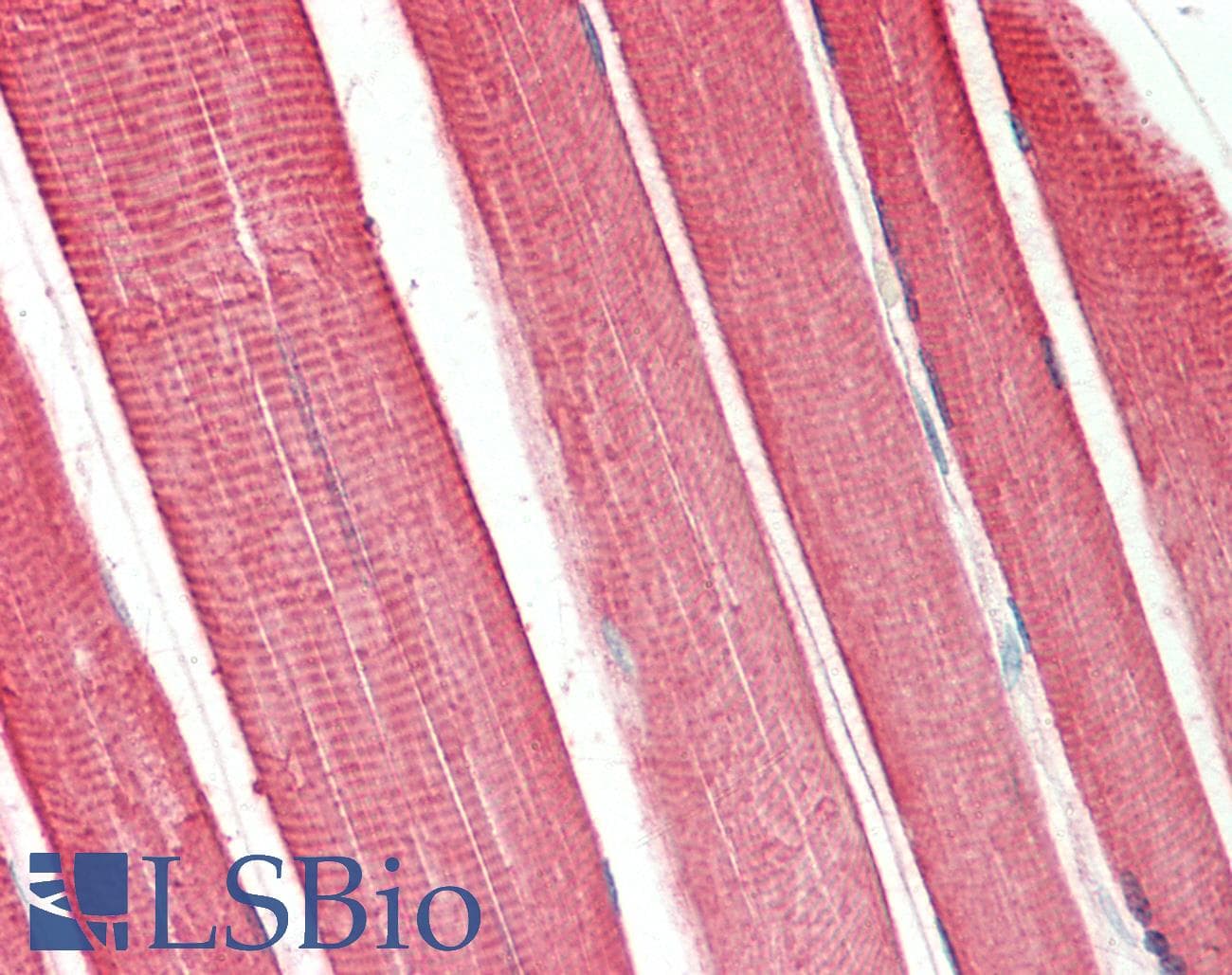 IHC-plus™ Monoclonal Mouse anti-Human TNNI2 Antibody (clone 2F12G2, IHC, IF, WB)