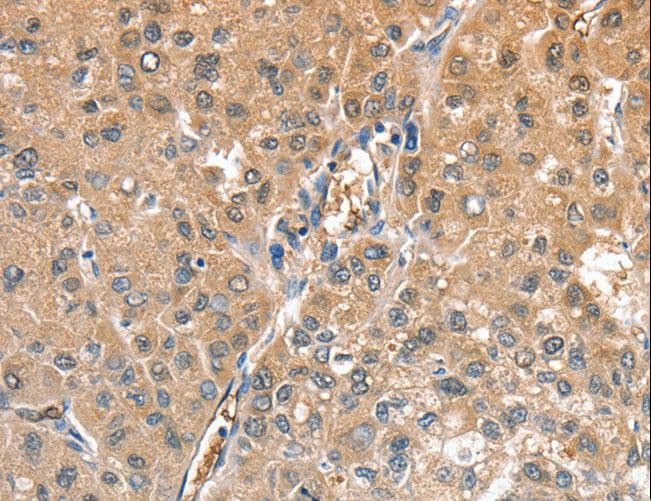 CIAPIN1 / Anamorsin Antibody