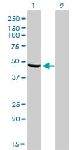 NDUFV1 Antibody (clone 4A7)